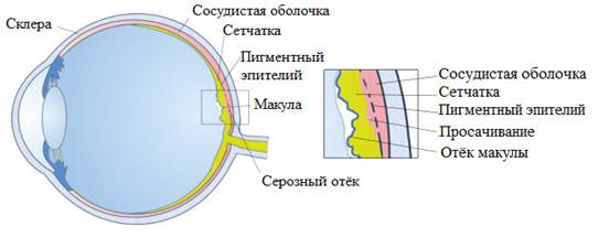 https://ophthalmocenter.ru/images/chrp-setchatki.jpg