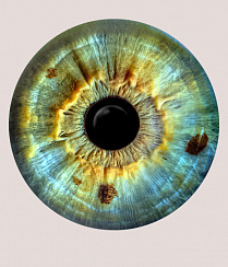 ПРОГРАММА Второе мнение по коррекции зрения (эксимер) БЕСПЛАТНО